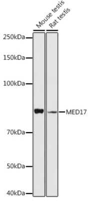 Western Blot: MED17 Antibody [NBP3-04651] - Western blot analysis of extracts of various cell lines, using MED17 antibody (NBP3-04651) at 1:1000 dilution. Secondary antibody: HRP Goat Anti-Rabbit IgG (H+L) at 1:10000 dilution. Lysates/proteins: 25ug per lane. Blocking buffer: 3% nonfat dry milk in TBST. Detection: ECL Basic Kit. Exposure time: 90s.